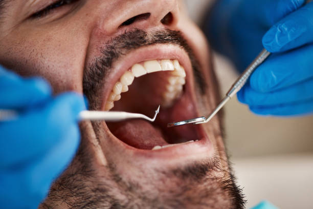 Best Chipped Tooth Repair Near Me  in Paloma Creek, TX